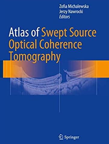 Atlas of Swept Source Optical Coherence Tomography Zofia Michalewska, ISBN-13: 978-3319498393