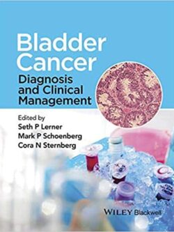 Bladder Cancer: Diagnosis and Clinical Management – eBook PDF