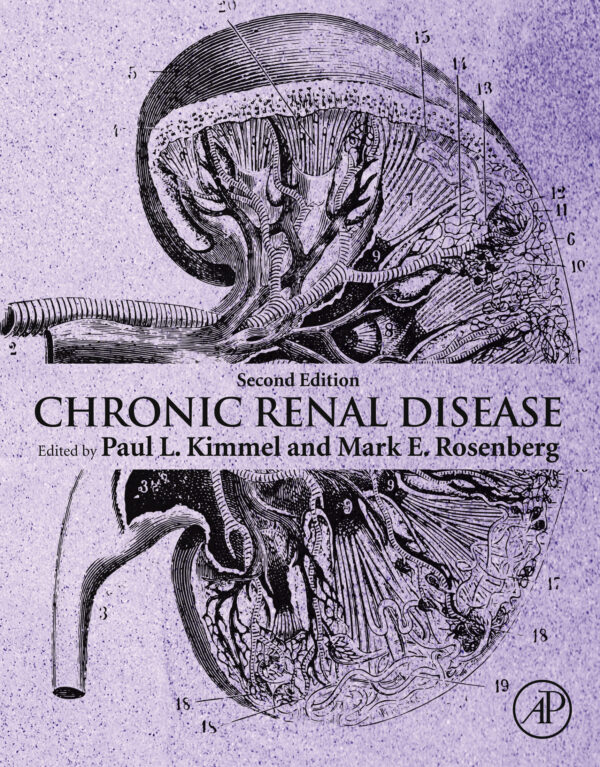 Chronic Renal Disease (2nd Edition) – eBook PDF