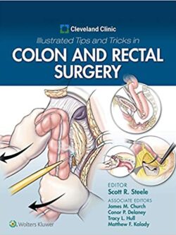 Cleveland Clinic Illustrated Tips and Tricks in Colon and Rectal Surgery – eBook PDF