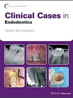 Clinical Cases in Endodontics – eBook PDF