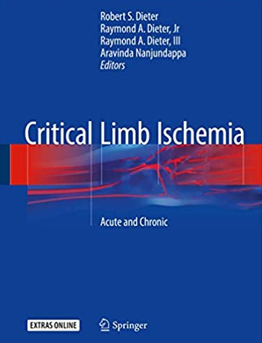 Critical Limb Ischemia: Acute and Chronic by Robert S. Dieter, ISBN-13: 978-3319319896