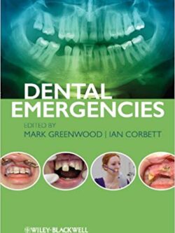 Dental Emergencies – eBook PDF