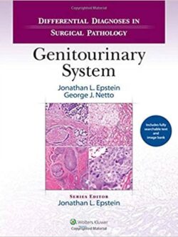 Differential Diagnoses in Surgical Pathology: Genitourinary System – eBook PDF