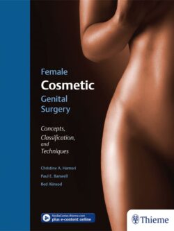 Female Cosmetic Genital Surgery: Concepts, Classification, and Techniques – eBook PDF