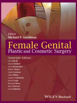 Female Genital Plastic and Cosmetic Surgery – eBook PDF