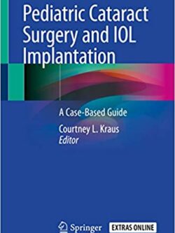 Pediatric Cataract Surgery and IOL Implantation: A Case-Based Guide – eBook PDF