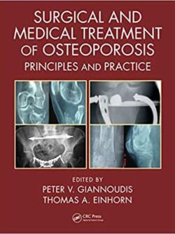 Surgical and Medical Treatment of Osteoporosis: Principles and Practice – eBook PDF